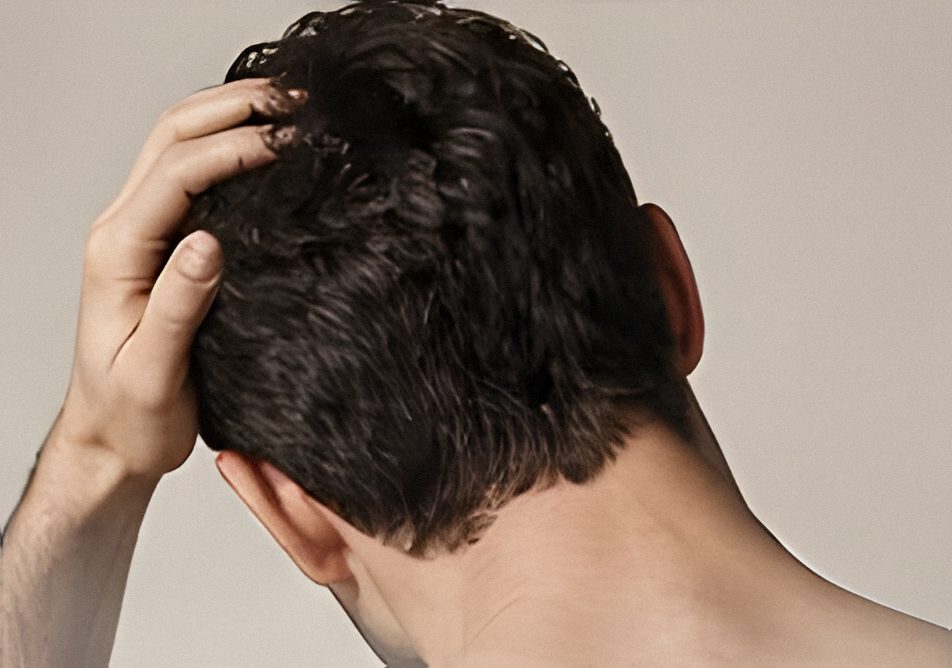 Hair Transplant